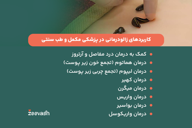 کاربردهای زالودرمانی در طب سنتی و پزشکی مکمل